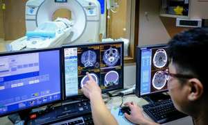 New technologies to diagnose and treat neurological diseases in Singapore (c) NTU Singapore