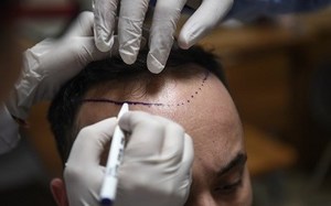 Medical tourism not a holiday for many Kurds (c) Ozan Kose AFP