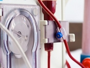 Less than 30pc of kidney patients manage to get dialysis in India (c) Business Standard